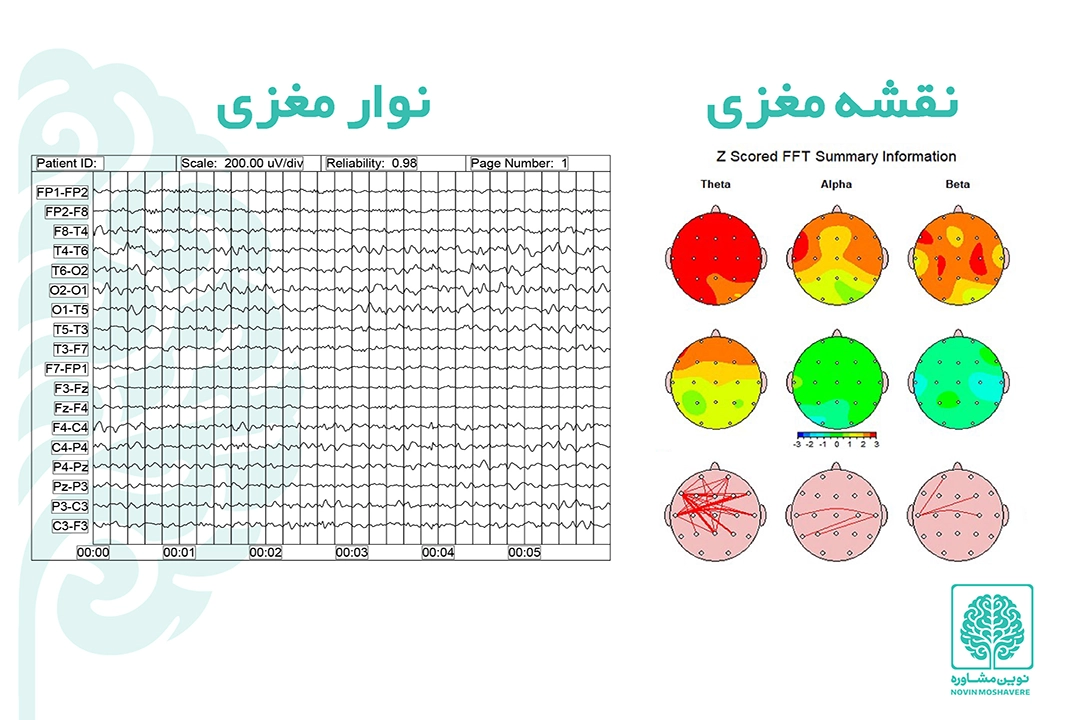 بالا بردن تمرکز هنگام درس خواندن