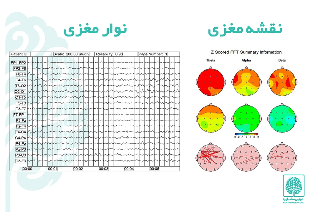 پرخاشگری کودکان و راه های طلایی درمان
