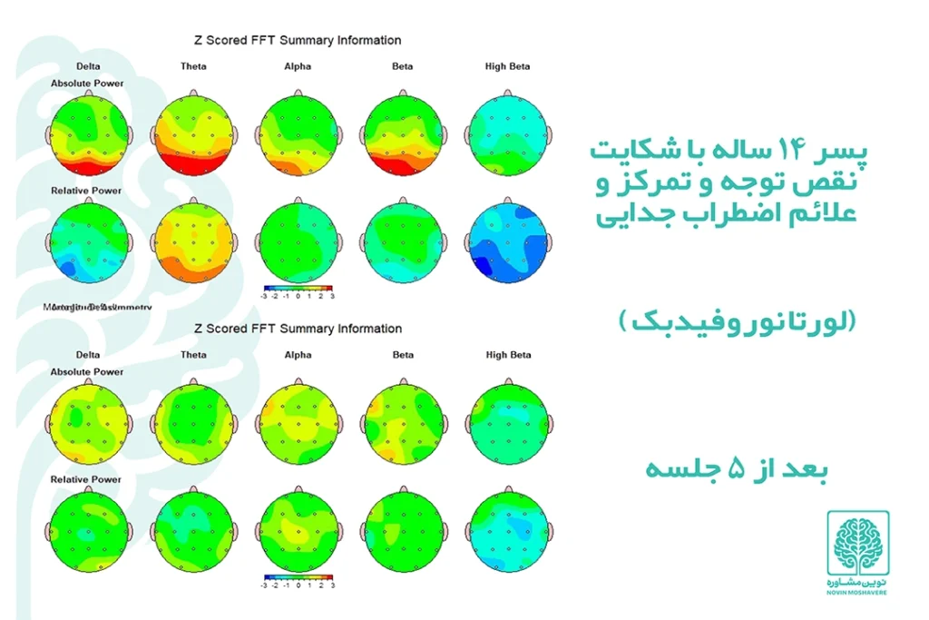 بهترین مرکز نقشه مغزی در تهران