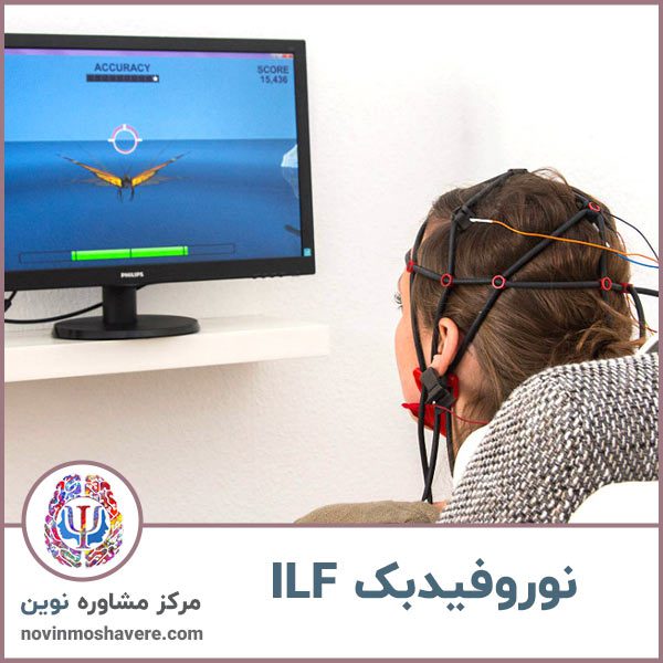 نوروفیدبک-ilf