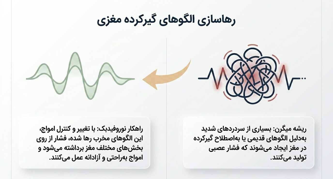 درمان میگرن