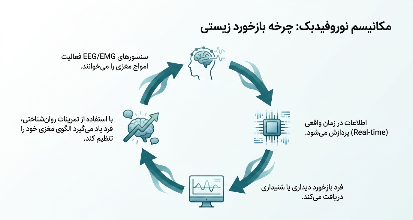 rtms چیست