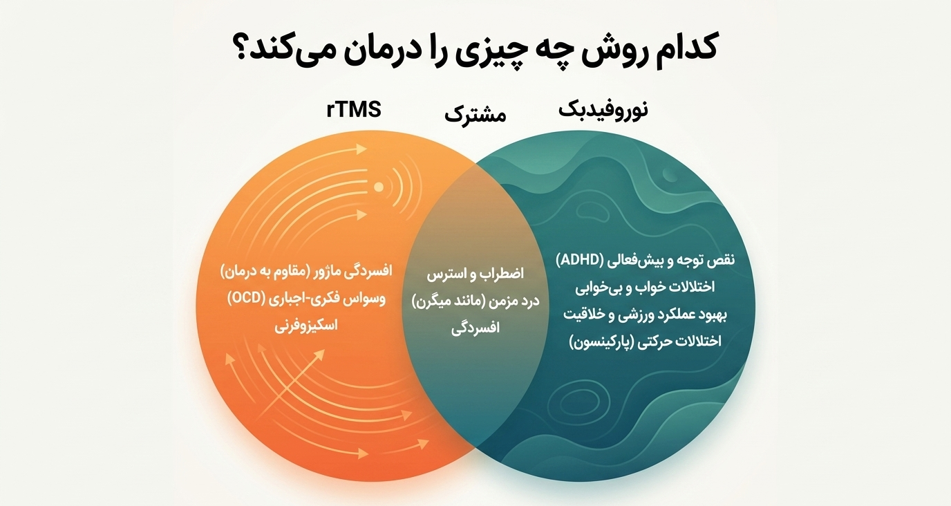 rtms چیست